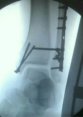 xray